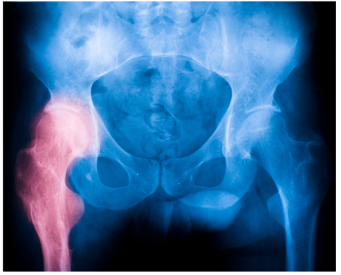 Maria Ciaccio Bowen5