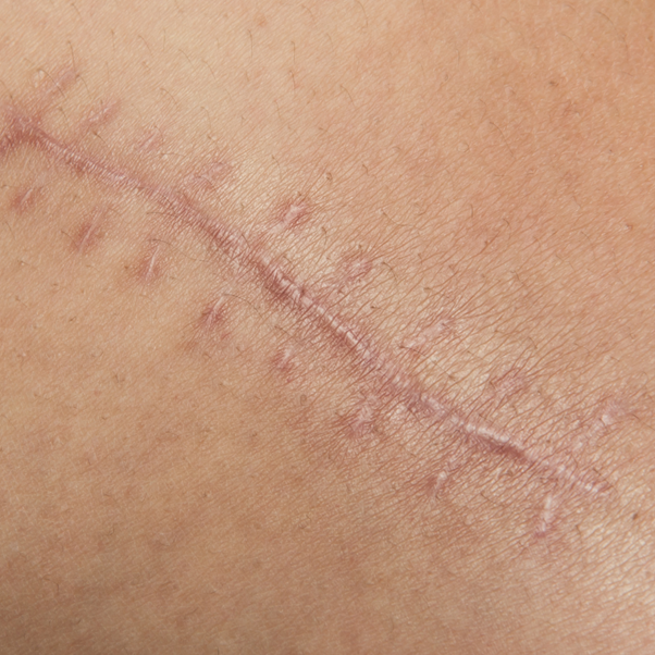 Maria Ciaccio Scarwork2