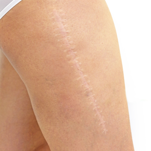 Maria Ciaccio Scarwork3